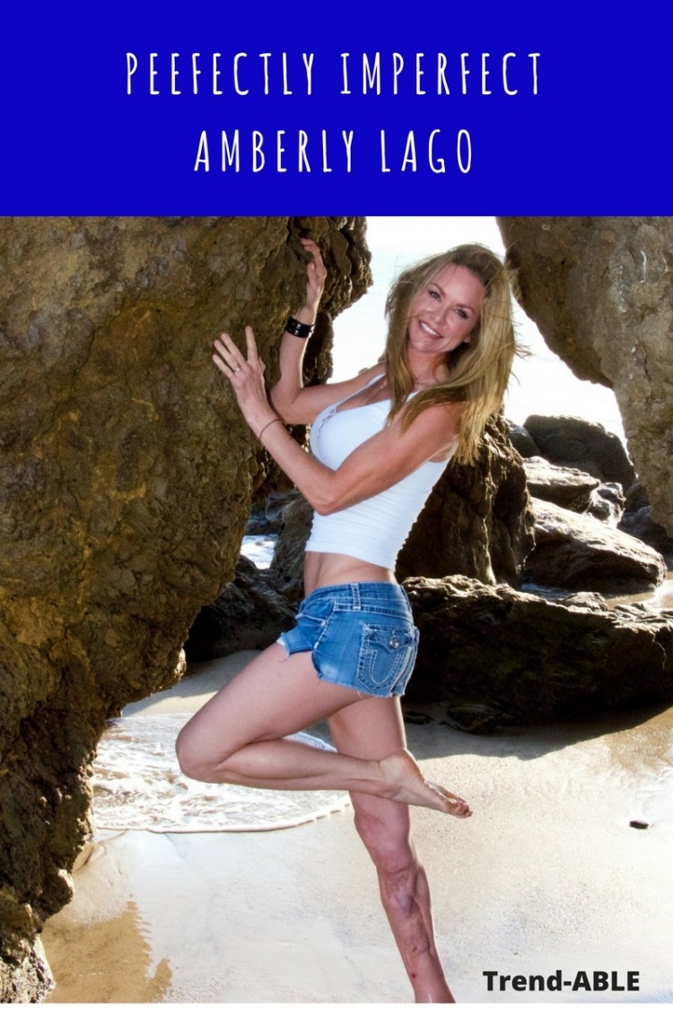 Woman with a nerve disorder & physical disability from an accident inspires