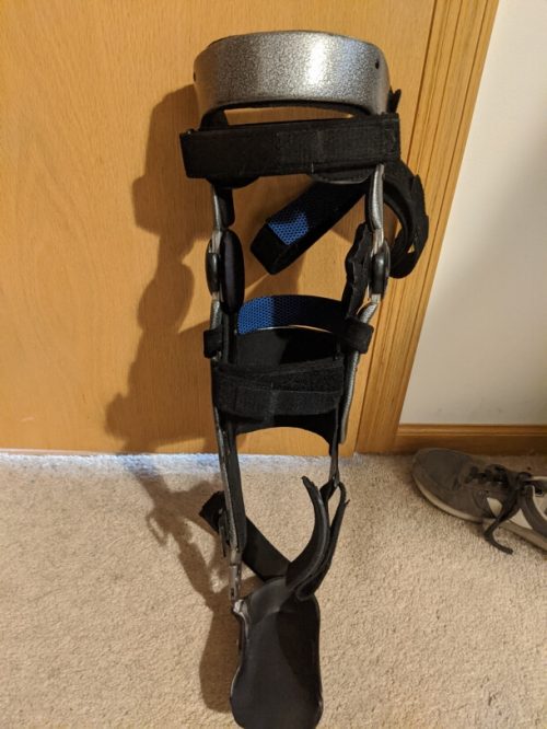 How I finally found sandals that fit my Kafos & disability