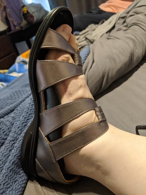 How I finally found sandals that fit my Kafos & disability